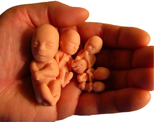 Фигурки зародышей ребенка на ладони