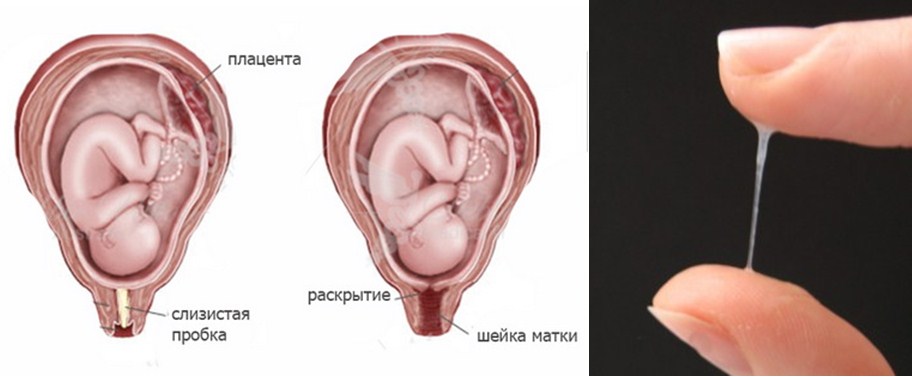 Схематическое изображение слизистой пробки